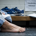 Tendinite releveur du pied : douleur au cou-de-pied en course