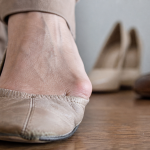 Oignon pied : bosse du gros orteil dans une chaussure serrée