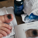 O rteil noir ongle : hématome, compresse froide et antiseptique